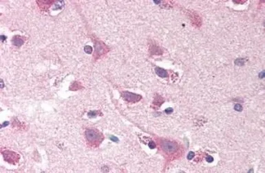 Anti-SMOC2 antibody used in IHC (Paraffin sections) (IHC-P). GTX85703