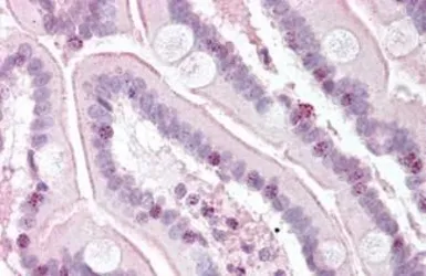 Anti-RTEL1 antibody used in IHC (Paraffin sections) (IHC-P). GTX85733