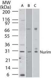 Anti-NRM antibody used in Western Blot (WB). GTX85768