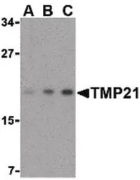 Anti-TMP21 antibody used in Western Blot (WB). GTX85769