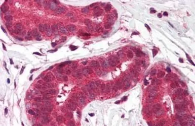 Anti-TMP21 antibody used in IHC (Paraffin sections) (IHC-P). GTX85770