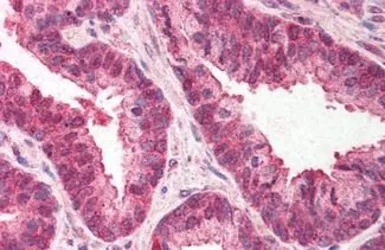 Anti-TMP21 antibody used in IHC (Paraffin sections) (IHC-P). GTX85770