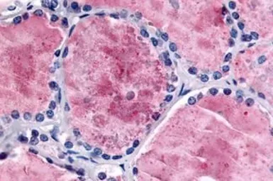 Anti-PDE8B antibody used in IHC (Paraffin sections) (IHC-P). GTX85801
