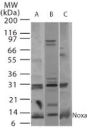 Anti-Noxa antibody used in Western Blot (WB). GTX85836
