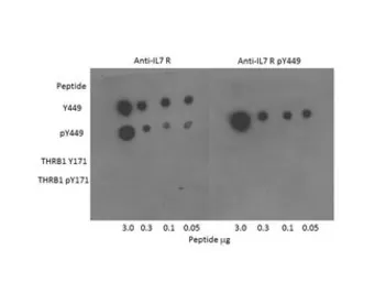 Anti-IL7 Receptor alpha antibody used in Western Blot (WB). GTX85865