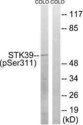 Anti-STK39 (phospho Ser311) antibody used in Western Blot (WB). GTX86495