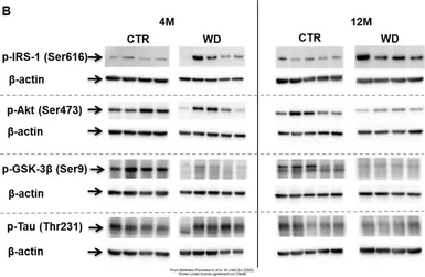 Anti-GSK3 beta (phospho Ser9) antibody used in Western Blot (WB). GTX86837