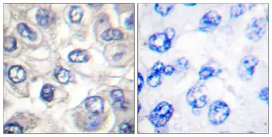 Anti-Bad (cleaved Asp71) antibody used in IHC (Paraffin sections) (IHC-P). GTX86887