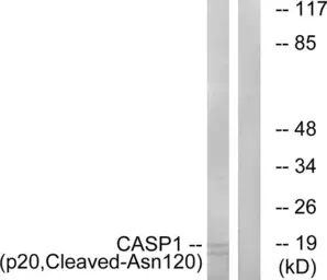 Anti-Caspase 1 (cleaved Asn120) antibody used in Western Blot (WB). GTX86897