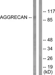 Anti-Aggrecan (cleaved Asp369) antibody used in Western Blot (WB). GTX86902