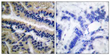 Anti-Caspase 9 (cleaved Asp353) antibody used in IHC (Paraffin sections) (IHC-P). GTX86912