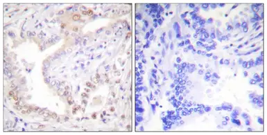 Anti-Lamin A (cleaved Asp230) antibody used in IHC (Paraffin sections) (IHC-P). GTX86918