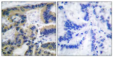 Anti-Caspase 7 (cleaved Asp198) antibody used in IHC (Paraffin sections) (IHC-P). GTX86925
