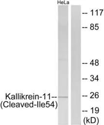 Anti-Kallikrein 11 (cleaved Ile54) antibody used in Western Blot (WB). GTX86927