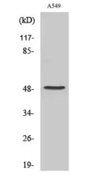 Anti-Factor X (cleaved Ala41) antibody used in Western Blot (WB). GTX86931
