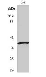 Anti-ICAD (cleaved Asp224) antibody used in Western Blot (WB). GTX86959