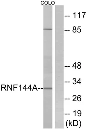 Anti-RNF144A antibody used in Western Blot (WB). GTX86994
