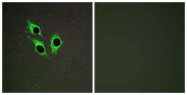 Anti-ANO9 antibody used in Immunocytochemistry/ Immunofluorescence (ICC/IF). GTX87030