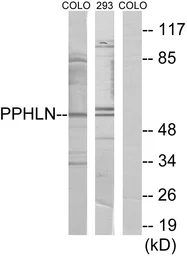 Anti-PPHLN antibody used in Western Blot (WB). GTX87045