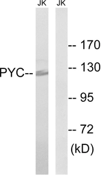 Anti-Pyruvate Carboxylase antibody used in Western Blot (WB). GTX87071