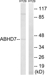Anti-ABHD7 antibody used in Western Blot (WB). GTX87116
