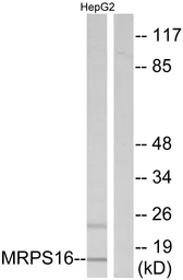 Anti-MRPS16 antibody used in Western Blot (WB). GTX87139