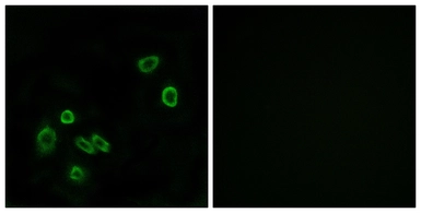 Anti-BRP44L antibody used in Immunocytochemistry/ Immunofluorescence (ICC/IF). GTX87153