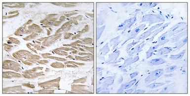 Anti-BRP44L antibody used in IHC (Paraffin sections) (IHC-P). GTX87153