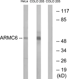 Anti-ARMC6 antibody used in Western Blot (WB). GTX87183