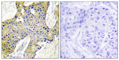 Anti-IARS2 antibody used in IHC (Paraffin sections) (IHC-P). GTX87187