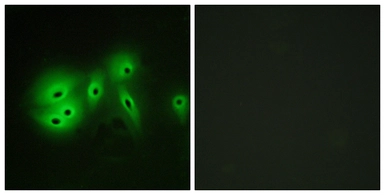 Anti-ADCY8 antibody used in Immunocytochemistry/ Immunofluorescence (ICC/IF). GTX87216