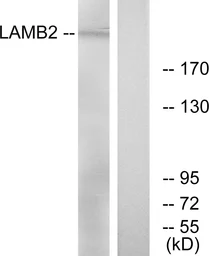 Anti-Laminin beta 2 antibody used in Western Blot (WB). GTX87258
