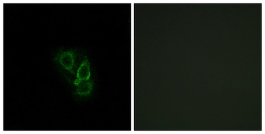 Anti-RAD antibody used in Immunocytochemistry/ Immunofluorescence (ICC/IF). GTX87282