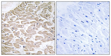 Anti-RAD antibody used in IHC (Paraffin sections) (IHC-P). GTX87282