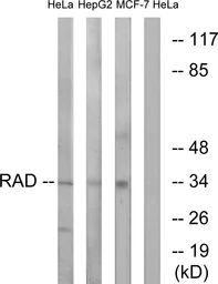 Anti-RAD antibody used in Western Blot (WB). GTX87282