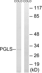 Anti-PGLS antibody used in Western Blot (WB). GTX87319