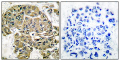 Anti-Mammaglobin B antibody used in IHC (Paraffin sections) (IHC-P). GTX87343
