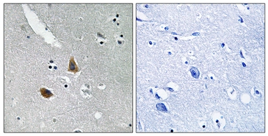 Anti-MRPL21 antibody used in IHC (Paraffin sections) (IHC-P). GTX87372