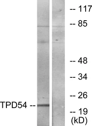 Anti-TPD52L2 antibody used in Western Blot (WB). GTX87379