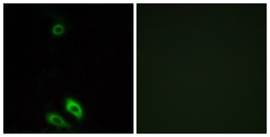 Anti-AKR1CL1 antibody used in Immunocytochemistry/ Immunofluorescence (ICC/IF). GTX87387