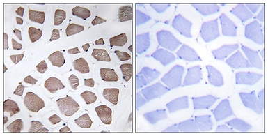Anti-MRPS18C antibody used in IHC (Paraffin sections) (IHC-P). GTX87389