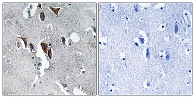 Anti-ELOVL5 antibody used in IHC (Paraffin sections) (IHC-P). GTX87413