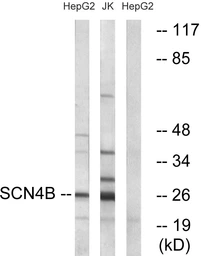Anti-SCN4B antibody used in Western Blot (WB). GTX87443