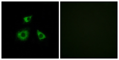 Anti-MRPL52 antibody used in Immunocytochemistry/ Immunofluorescence (ICC/IF). GTX87484