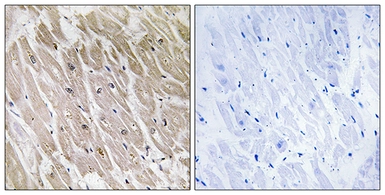 Anti-ACAD10 antibody used in IHC (Paraffin sections) (IHC-P). GTX87500