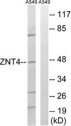 Anti-SLC30A4 antibody used in Western Blot (WB). GTX87502