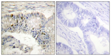 Anti-Histone H1 antibody used in IHC (Paraffin sections) (IHC-P). GTX87506