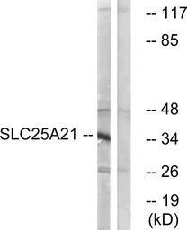 Anti-SLC25A21 antibody used in Western Blot (WB). GTX87583