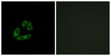 Anti-ARFIP1 antibody used in Immunocytochemistry/ Immunofluorescence (ICC/IF). GTX87641
