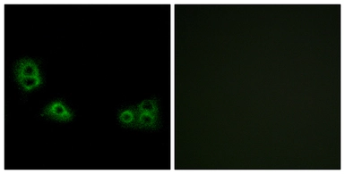 Anti-TMEM185A antibody used in Immunocytochemistry/ Immunofluorescence (ICC/IF). GTX87650